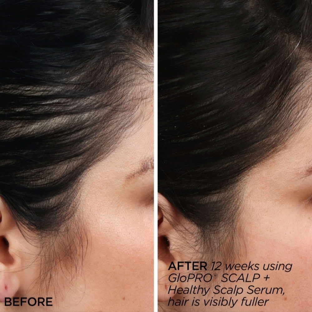BeautyBio Scalp Therapy Set - Picture 8 of 11
